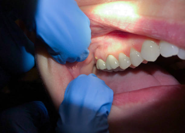 Best Urgent Care for Lost Fillings or Crowns in Gaston, SC